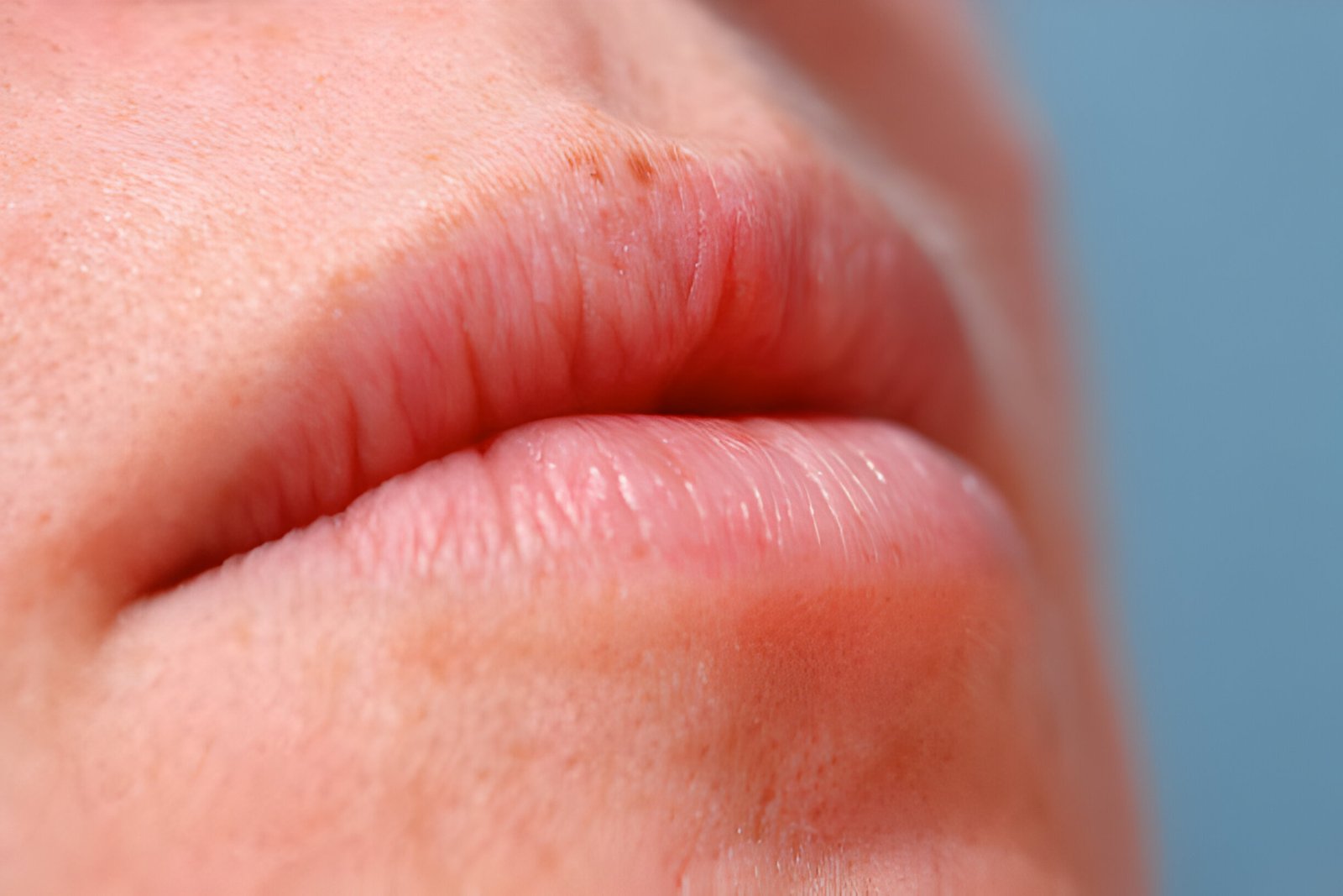 Eczema on Lips: Identifying Triggers and Managing Symptoms