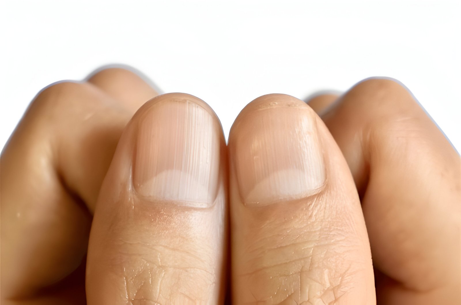 Half Moon Nails: What They Reveal About Your Health