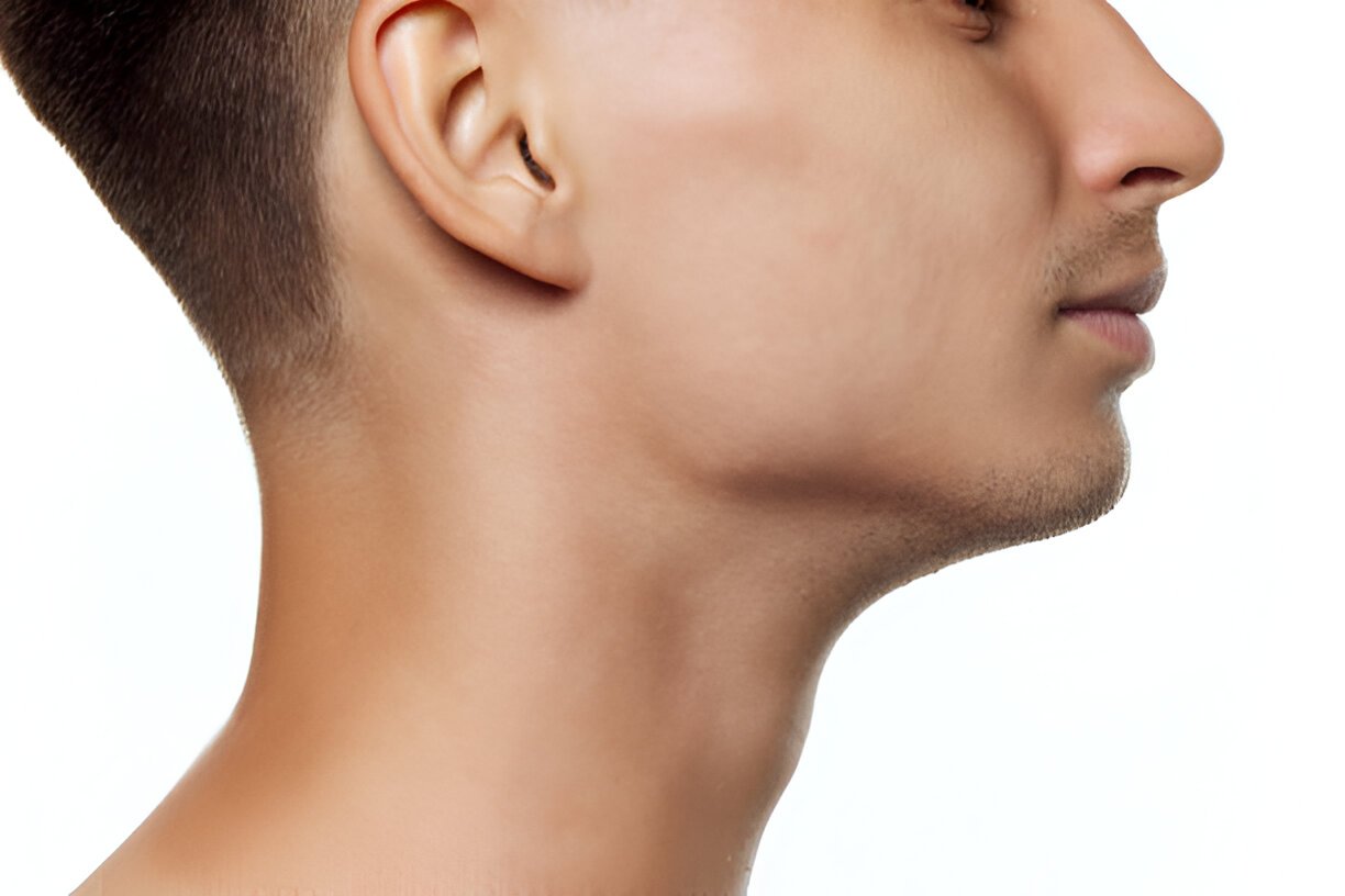 Jawline Enhancement: Non-Surgical Options and Exercises