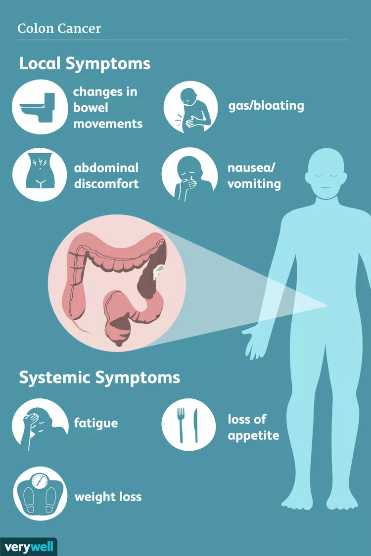 bowel cancer stomach noises Understanding the Symptoms, Causes, and Treatments